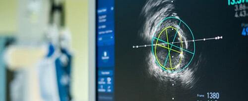 close-up of medical machine