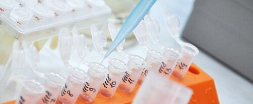 medical test tubes