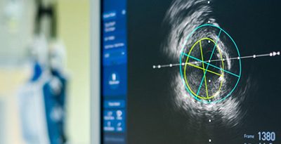 New FDA Guidelines Affect Labeling Consideration for Intravascular Devices with Lubricious Coatings