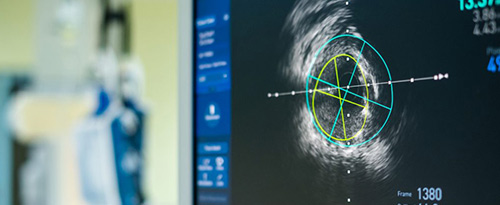 New FDA Guidelines Affect Labeling Consideration for Intravascular Devices with Lubricious Coatings