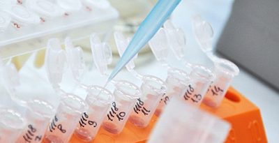 IVDR: What You Need to Know about Europe’s Changing IVD Market