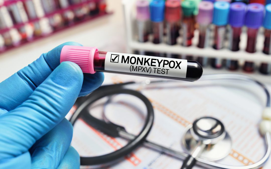 New FDA Guidance Doc Lays Bare Process For Requesting EUAs For Monkeypox Diagnostics